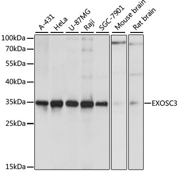 EXOSC3 Antibody in Western Blot (WB)