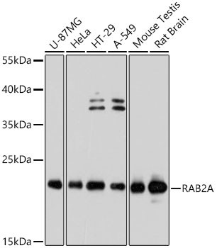 RAB2A Antibody in Western Blot (WB)