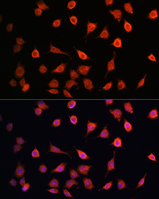 MRPS27 Antibody in Immunocytochemistry (ICC/IF)