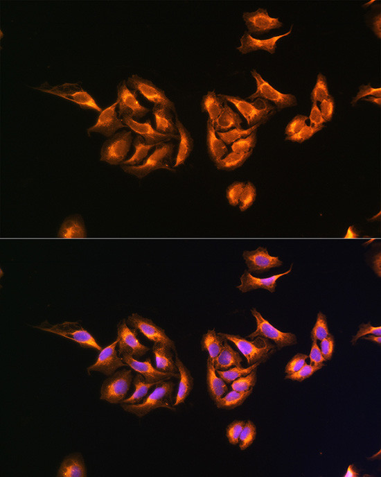 MRPS27 Antibody in Immunocytochemistry (ICC/IF)