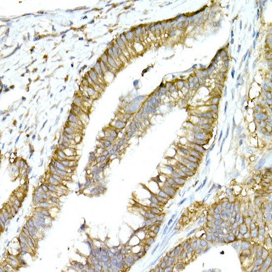 NKCC1 Antibody in Immunohistochemistry (Paraffin) (IHC (P))