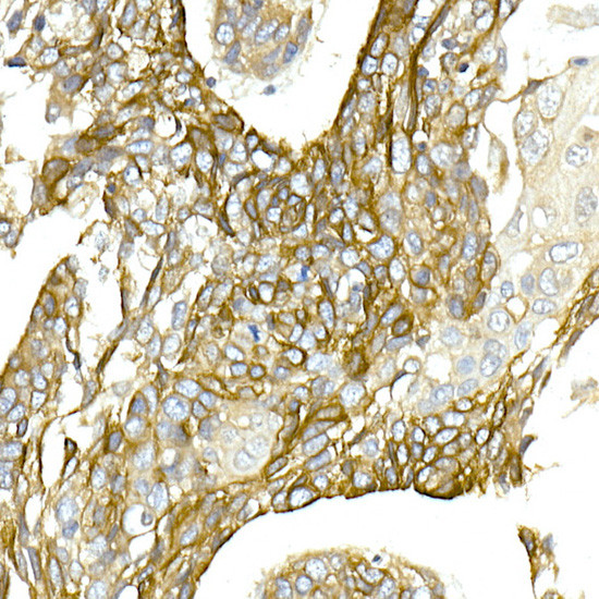 NKCC1 Antibody in Immunohistochemistry (Paraffin) (IHC (P))