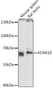 KCNK10 Antibody in Western Blot (WB)