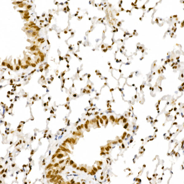 ALKBH5 Antibody in Immunohistochemistry (Paraffin) (IHC (P))