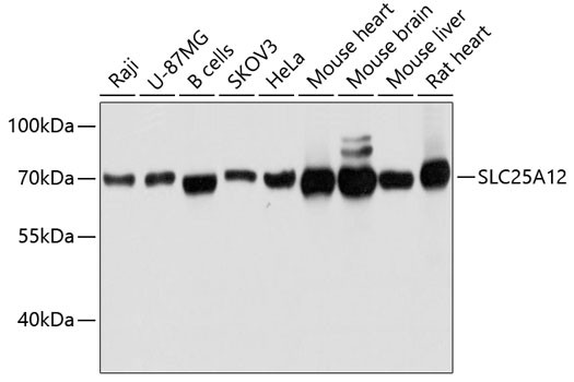 SLC25A12 Antibody in Western Blot (WB)