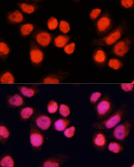 CHAMP1 Antibody in Immunocytochemistry (ICC/IF)