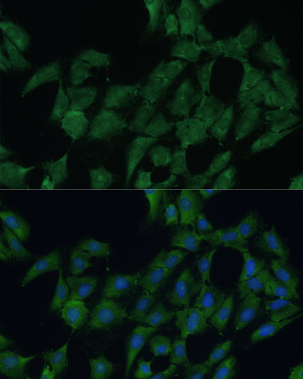 DDX3Y Antibody in Immunocytochemistry (ICC/IF)