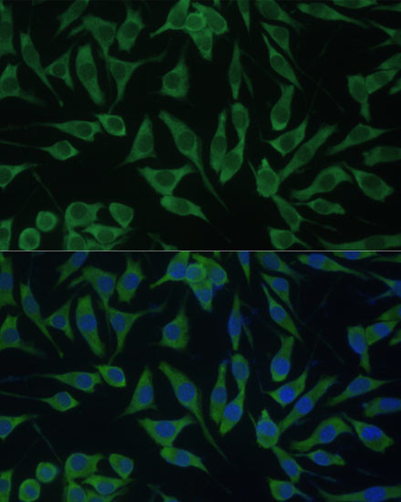 DDX3Y Antibody in Immunocytochemistry (ICC/IF)