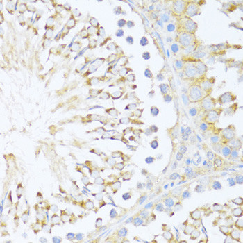 DDX3Y Antibody in Immunohistochemistry (Paraffin) (IHC (P))