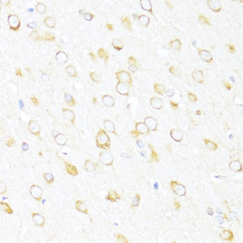 DDX3Y Antibody in Immunohistochemistry (Paraffin) (IHC (P))