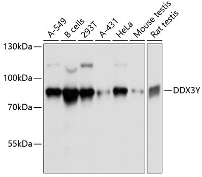 DDX3Y Antibody in Western Blot (WB)