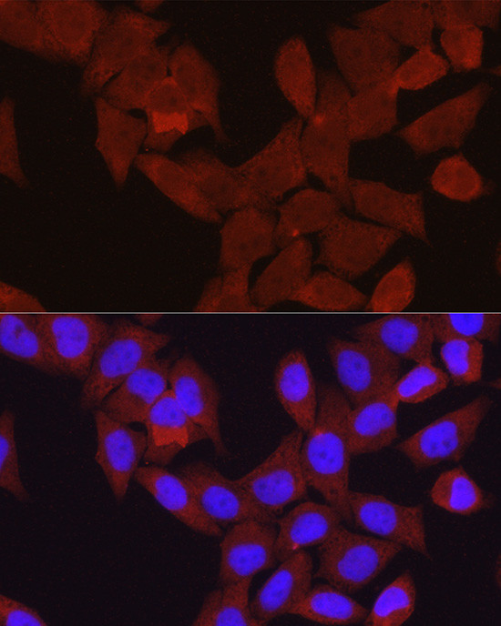 beta-Arrestin 2 Antibody in Immunocytochemistry (ICC/IF)