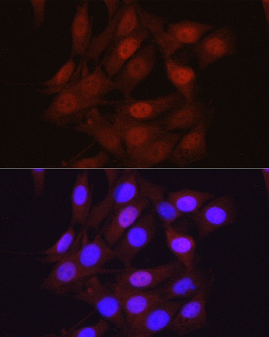 beta-Arrestin 2 Antibody in Immunocytochemistry (ICC/IF)