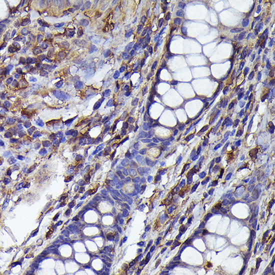 beta-Arrestin 2 Antibody in Immunohistochemistry (Paraffin) (IHC (P))