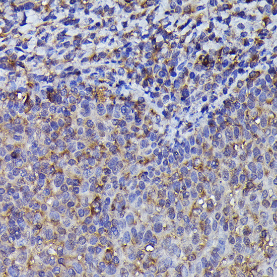 beta-Arrestin 2 Antibody in Immunohistochemistry (Paraffin) (IHC (P))