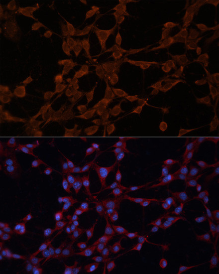 P-Glycoprotein Antibody in Immunocytochemistry (ICC/IF)