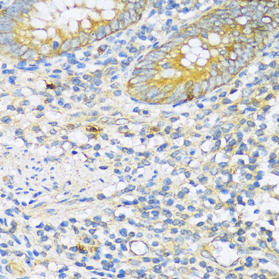 TGFBR2 Antibody in Immunohistochemistry (Paraffin) (IHC (P))