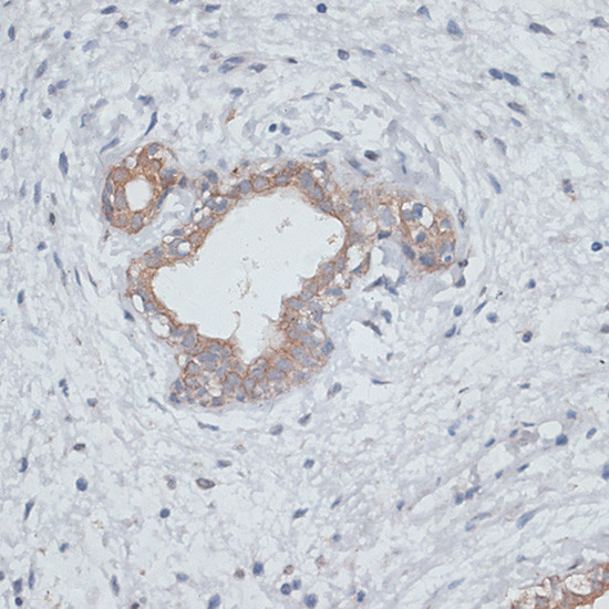 TGFBR2 Antibody in Immunohistochemistry (Paraffin) (IHC (P))