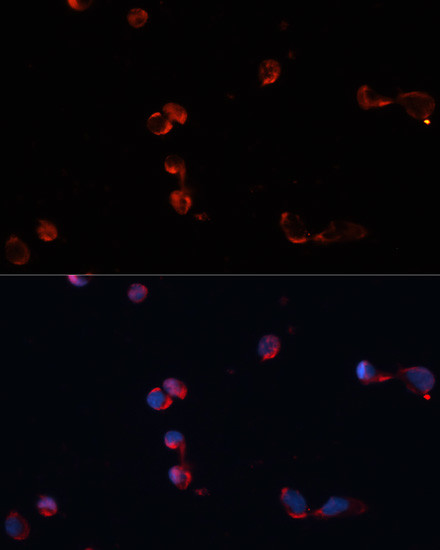 Catalase Antibody in Immunocytochemistry (ICC/IF)