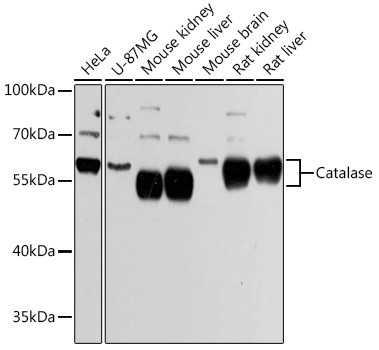 Catalase Antibody in Western Blot (WB)