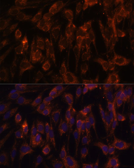 TLR3 Antibody in Immunocytochemistry (ICC/IF)