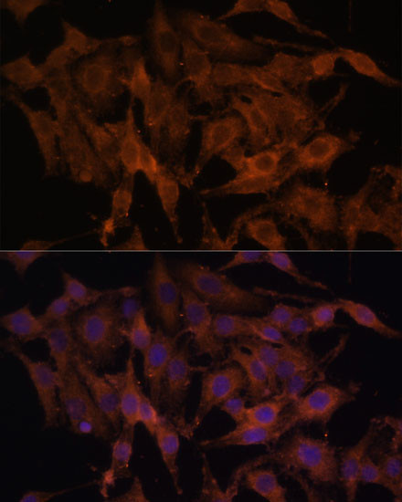 TLR3 Antibody in Immunocytochemistry (ICC/IF)