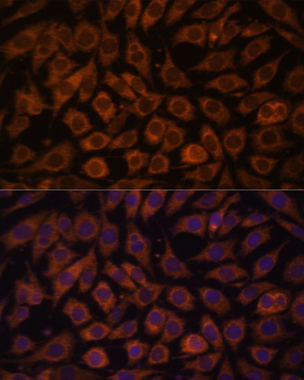 TLR3 Antibody in Immunocytochemistry (ICC/IF)