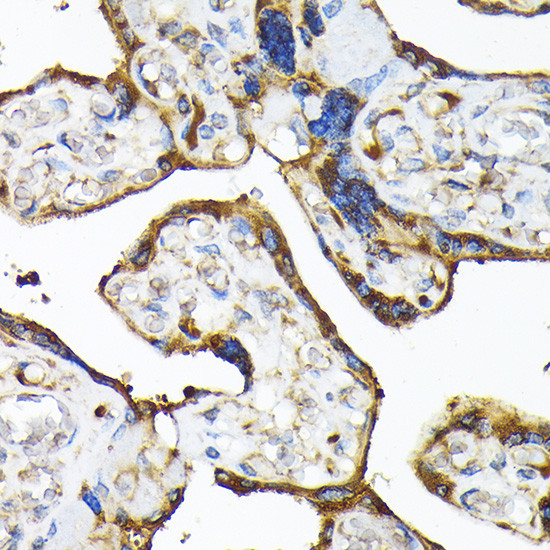 TLR3 Antibody in Immunohistochemistry (Paraffin) (IHC (P))