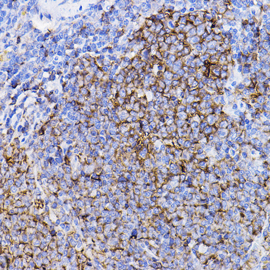 TGFBR2 Antibody in Immunohistochemistry (Paraffin) (IHC (P))