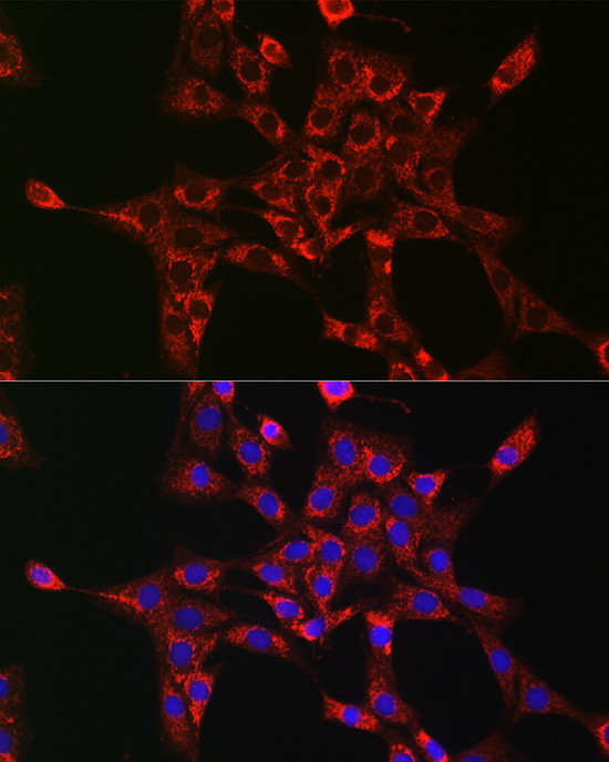 RAB5 Antibody in Immunocytochemistry (ICC/IF)