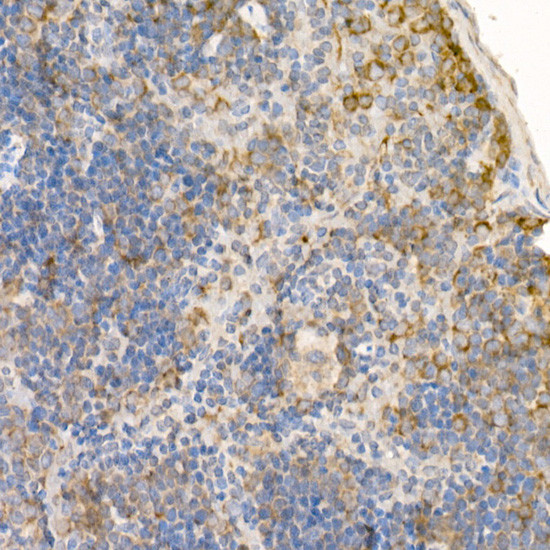 RAB5 Antibody in Immunohistochemistry (Paraffin) (IHC (P))