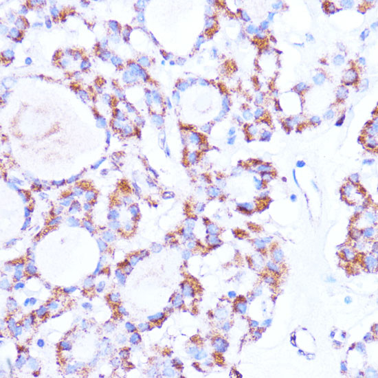 ISG15 Antibody in Immunohistochemistry (Paraffin) (IHC (P))