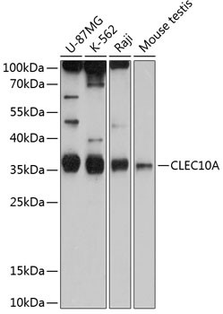 CD301 Antibody in Western Blot (WB)
