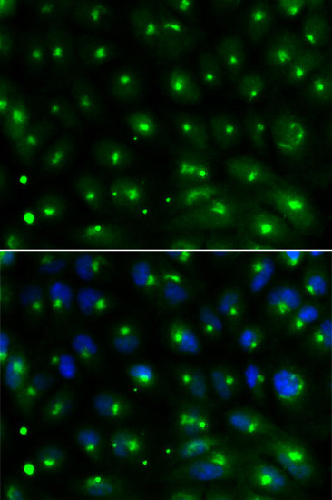 GGA2 Antibody in Immunocytochemistry (ICC/IF)