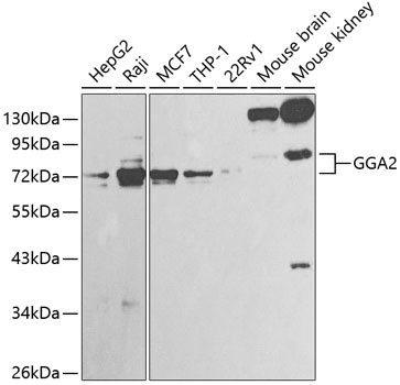 GGA2 Antibody in Western Blot (WB)