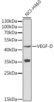 VEGFD Antibody in Western Blot (WB)