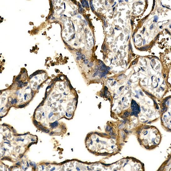 PDGF-BB Antibody in Immunohistochemistry (Paraffin) (IHC (P))