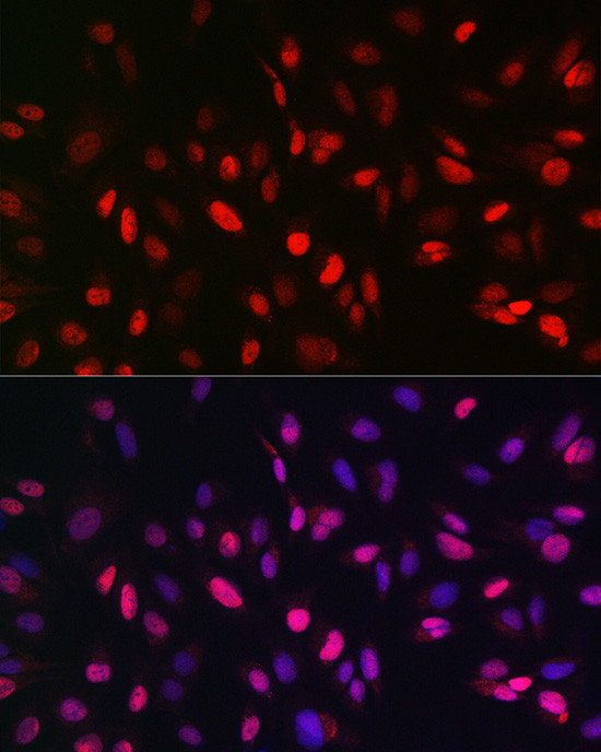 JMJD1A Antibody in Immunocytochemistry (ICC/IF)