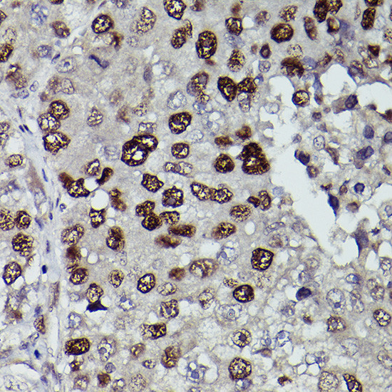 JMJD1A Antibody in Immunohistochemistry (Paraffin) (IHC (P))