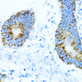 NOX1 Antibody in Immunohistochemistry (Paraffin) (IHC (P))