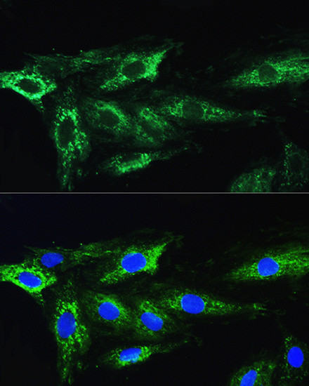 ATG16L1 Antibody in Immunocytochemistry (ICC/IF)