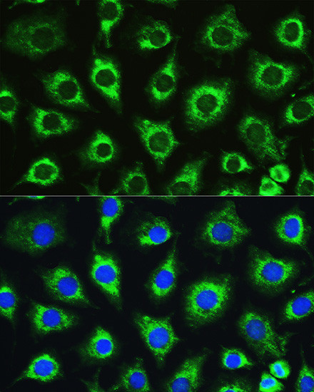 ATG16L1 Antibody in Immunocytochemistry (ICC/IF)