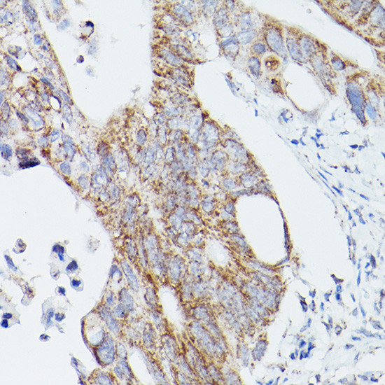 ATG16L1 Antibody in Immunohistochemistry (Paraffin) (IHC (P))