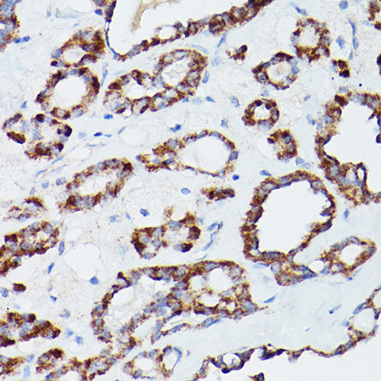 ATG16L1 Antibody in Immunohistochemistry (Paraffin) (IHC (P))