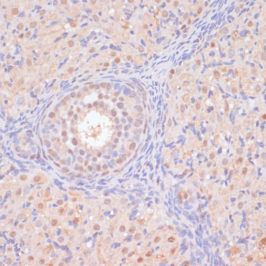 BYSL Antibody in Immunohistochemistry (Paraffin) (IHC (P))