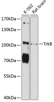 TrkB Antibody in Western Blot (WB)