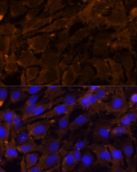 MMP3 Antibody in Immunocytochemistry (ICC/IF)