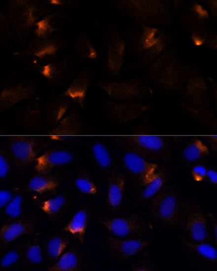 MMP3 Antibody in Immunocytochemistry (ICC/IF)