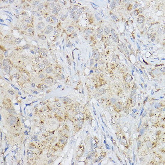 MMP3 Antibody in Immunohistochemistry (Paraffin) (IHC (P))