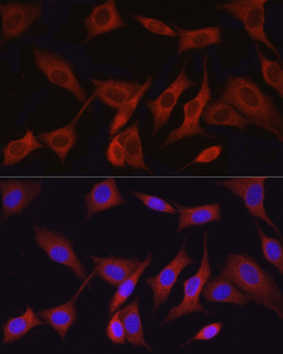 TAK1 Antibody in Immunocytochemistry (ICC/IF)